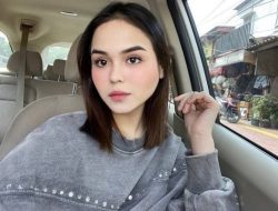 Selebgram Laura Anna Meninggal Dunia