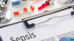 Ilustrasi sepsis.