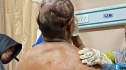 Korban serangan harimau sumatera di Kecamatan Sekincau, Kabupaten Lampung Bara