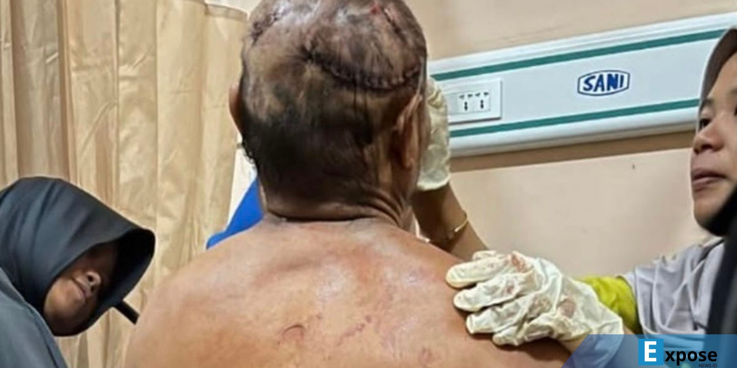 Korban serangan harimau sumatera di Kecamatan Sekincau, Kabupaten Lampung Bara